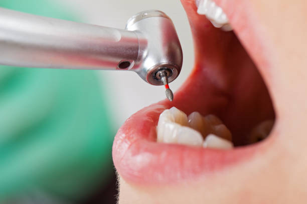 Best Emergency Treatment for Toothache in Agua Fria, NM